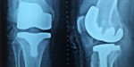 Orthopaedic Surgery Grand Rounds Orthopaedic Surgery Grand Rounds